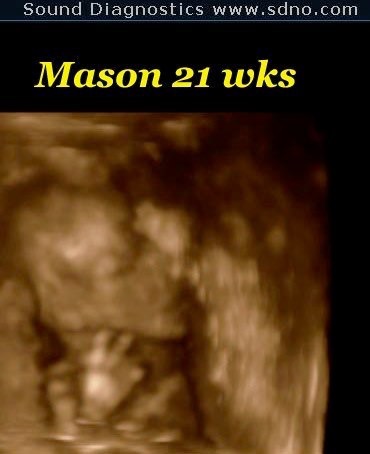 mason21w1