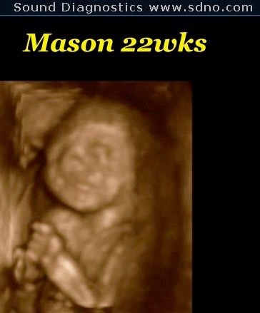 mason22w2