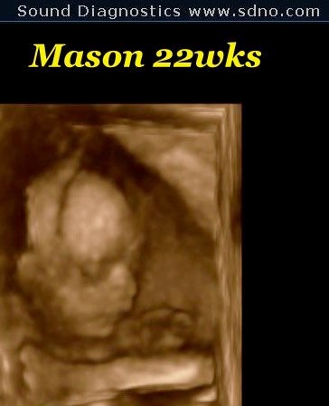 mason22w7