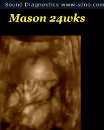 mason24w1