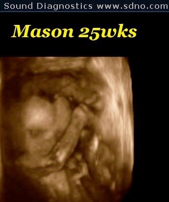 mason25w3