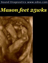 mason25w5