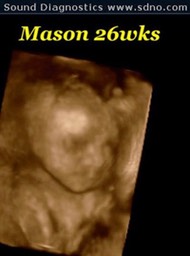 mason26w3